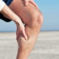 Cómo afectan las varices al rendimiento deportivo