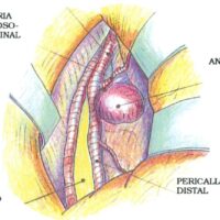 Presentamos el Polar Verity Sense la alternativa a la cinta pectoral