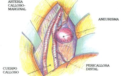 presentamos el polar verity sense la alternativa a la cinta pectoral