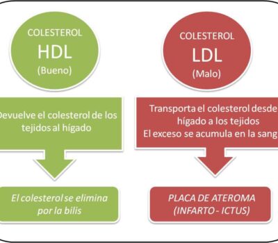 tipos de colesterol cual es el bueno y el malo
