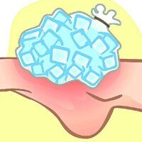 Si te lesiones en bicicleta: ¿Que ss mejor aplicar frío o calor para recuperarse?