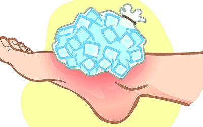 con lesion durante el ciclismo es mejor aplicar frio o calor para recuperarse