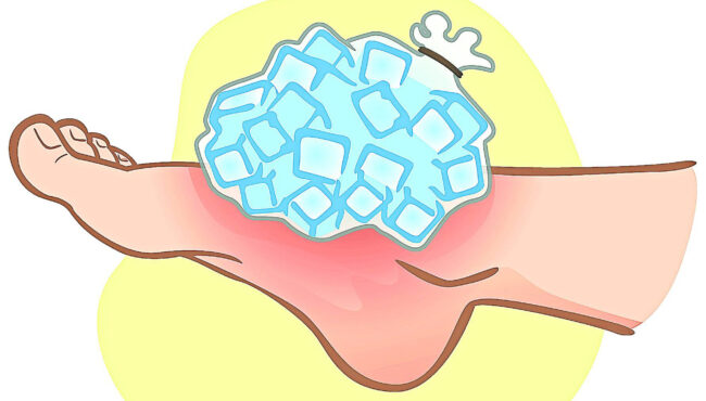 con lesion durante el ciclismo es mejor aplicar frio o calor para recuperarse