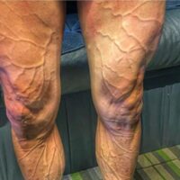 Adelgazar piernas con bicicleta: ¿es posible? Descubre cómo.